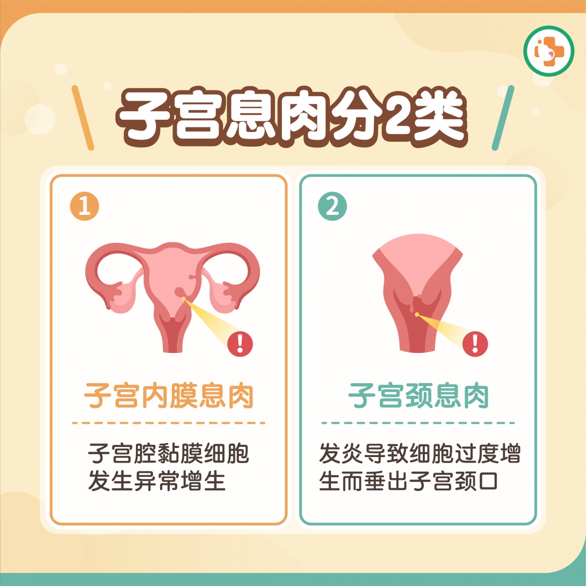 子宫息肉分为子宫内膜息肉及子宫颈息肉 子宫息肉分为子宫内膜息肉及子宫颈息肉