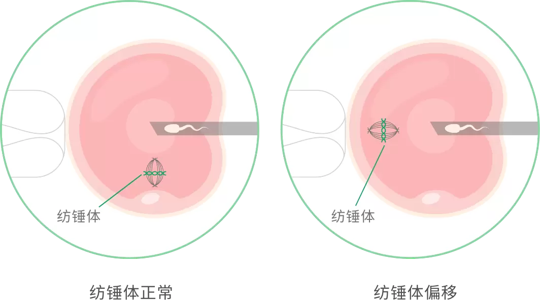 茂盛透过专业胚胎师的精准判读 实践真正的精准医疗